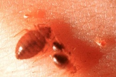 bunch_of_bed_bugs_feeding