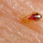 bed-bug-nymph-on-human-skin